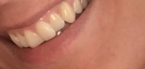 Gelbe Zähne Ursache?