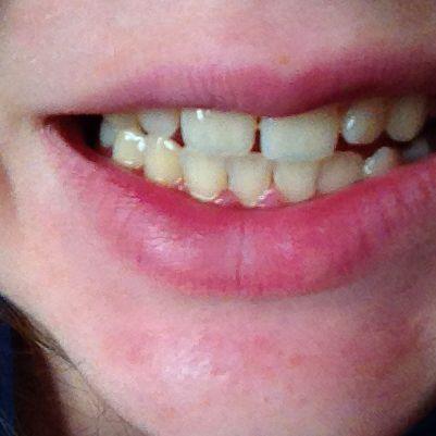 Das sind meine zähne nicht erschrecken  - (Gesundheit, Medizin, Zähne)