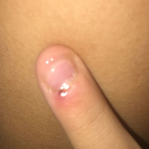 das ist mein finger nagel - (Pflege, Nägel, Gelnägel)
