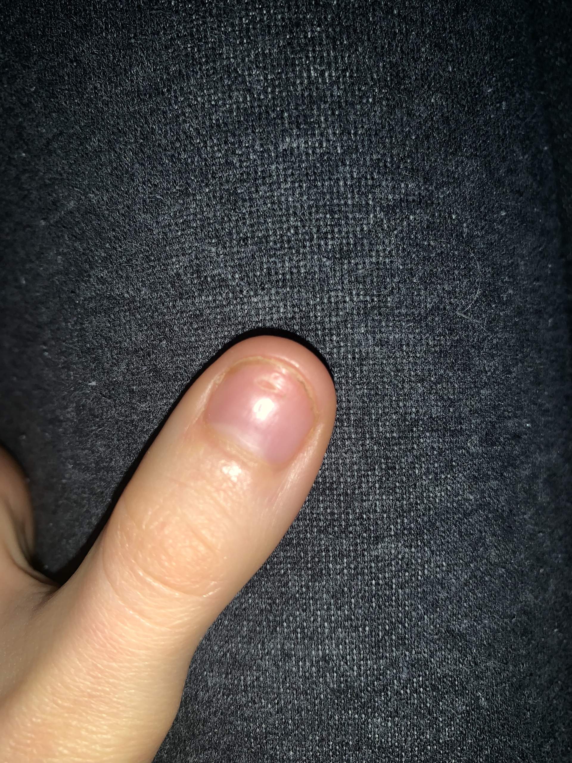 Gelnägel bei solchen naturnägeln? (Gesundheit, Beauty, Nägel)