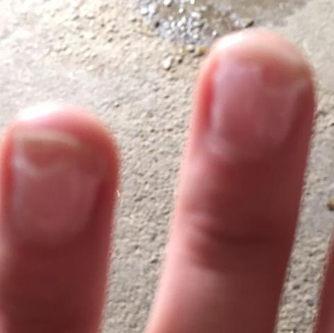 Nach 2 Wochen direkt 2 Nägel abgebrochen  - (Gel, Nails)