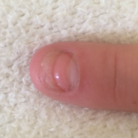 Gelnagel Auf Halben Naturnagel Nagel Gelnagel