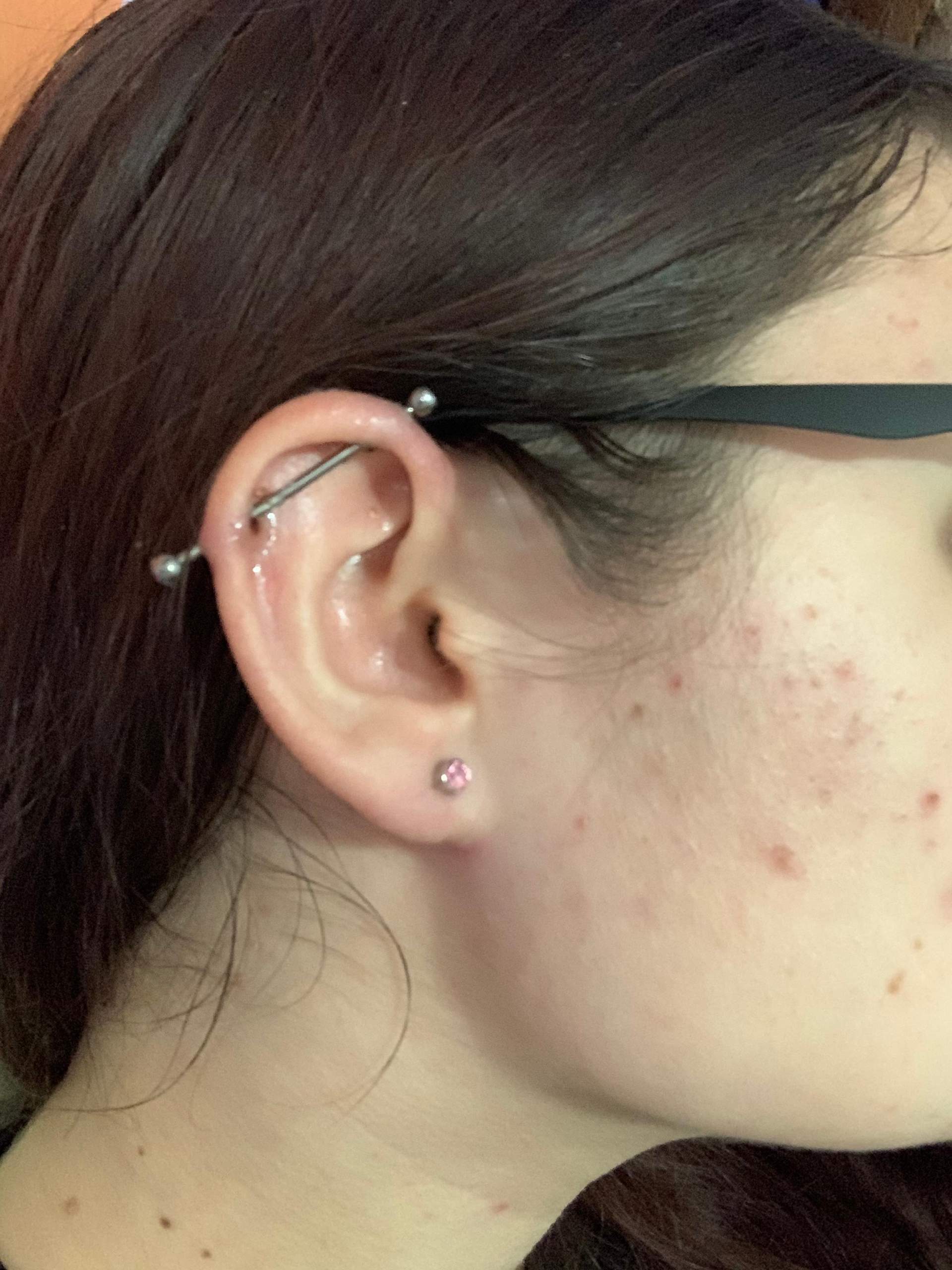 Gelschicht bei Piercing? (Piercingstudio, Ohrknorpelpiercing)