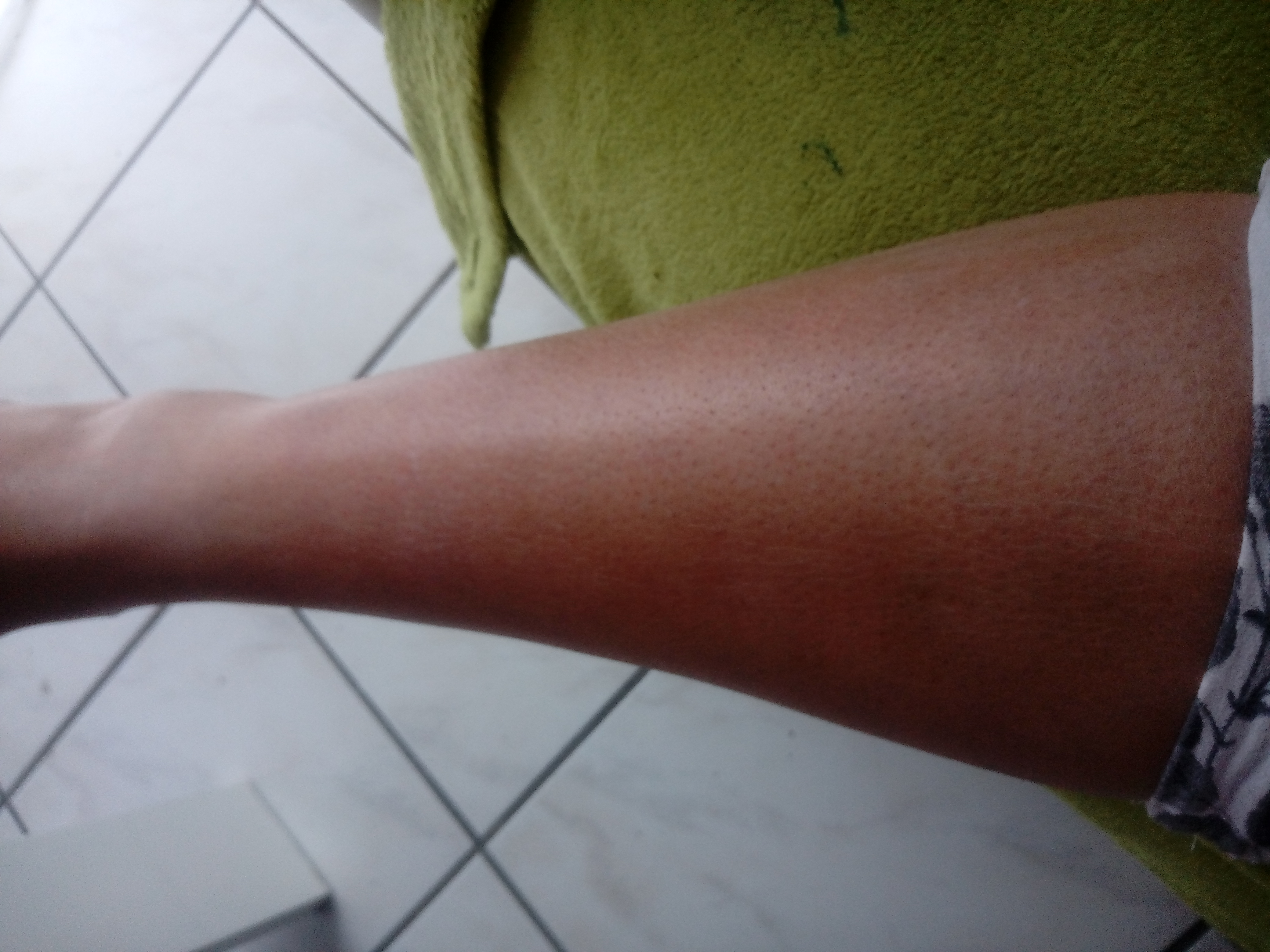 Warum Tut Mein Knie Weh Gerade ausgerutscht und mein Knöchel zwischen den Fuß und den Knie tut