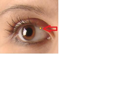 Gerstenkorn Hausarzt Oder Augenarzt Schmerzen Augen Gerstenkorn Hausarzt Oder Augenarzt Schmerzen Augen