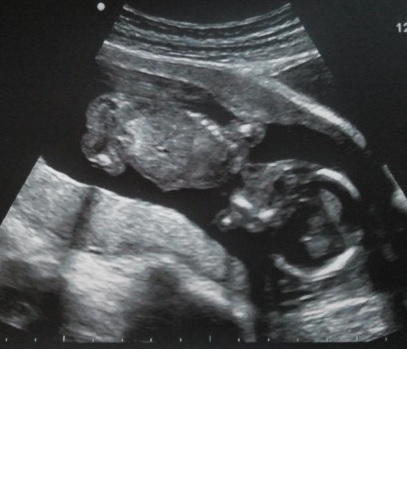 Geschlecht auf Bild erkennen, kann mir jemand ne Antwort ...