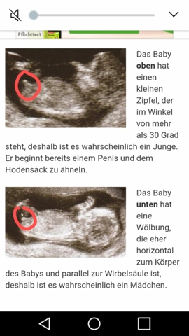Geschlecht Baby Erkennen Ultraschall