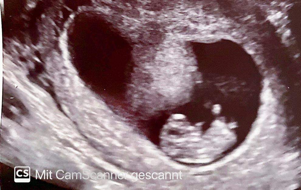 Geschlecht, Junge oder Mädchen? (schwanger, Baby, Gynäkologe)