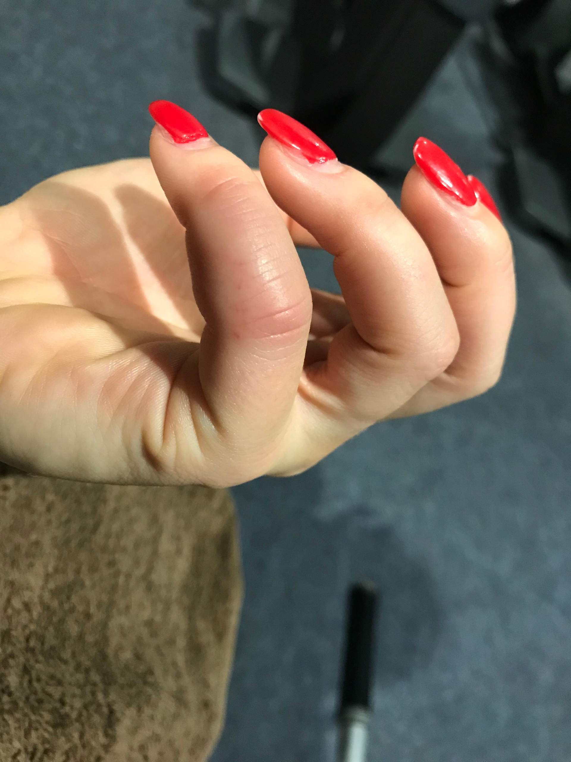 Geschwollene Finger im Winter warum?