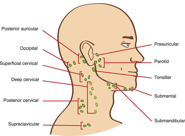 Geschwollener Lymphknoten Tonsillar Gesundheit Und Medizin Schwellung Geschwollener Lymphknoten Tonsillar Gesundheit Und Medizin Schwellung