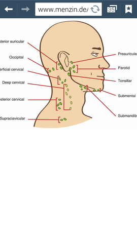 Geschwollener Lymphknoten Tonsillar Geschwollener Lymphknoten Tonsillar