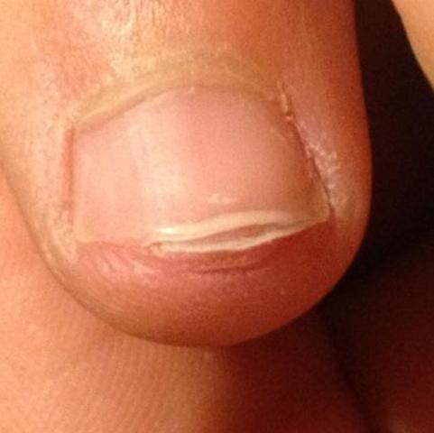 Gespaltene Nagel Was Tun Beauty Pflege Nagellack Gespaltene Nagel Was Tun Beauty Pflege Nagellack