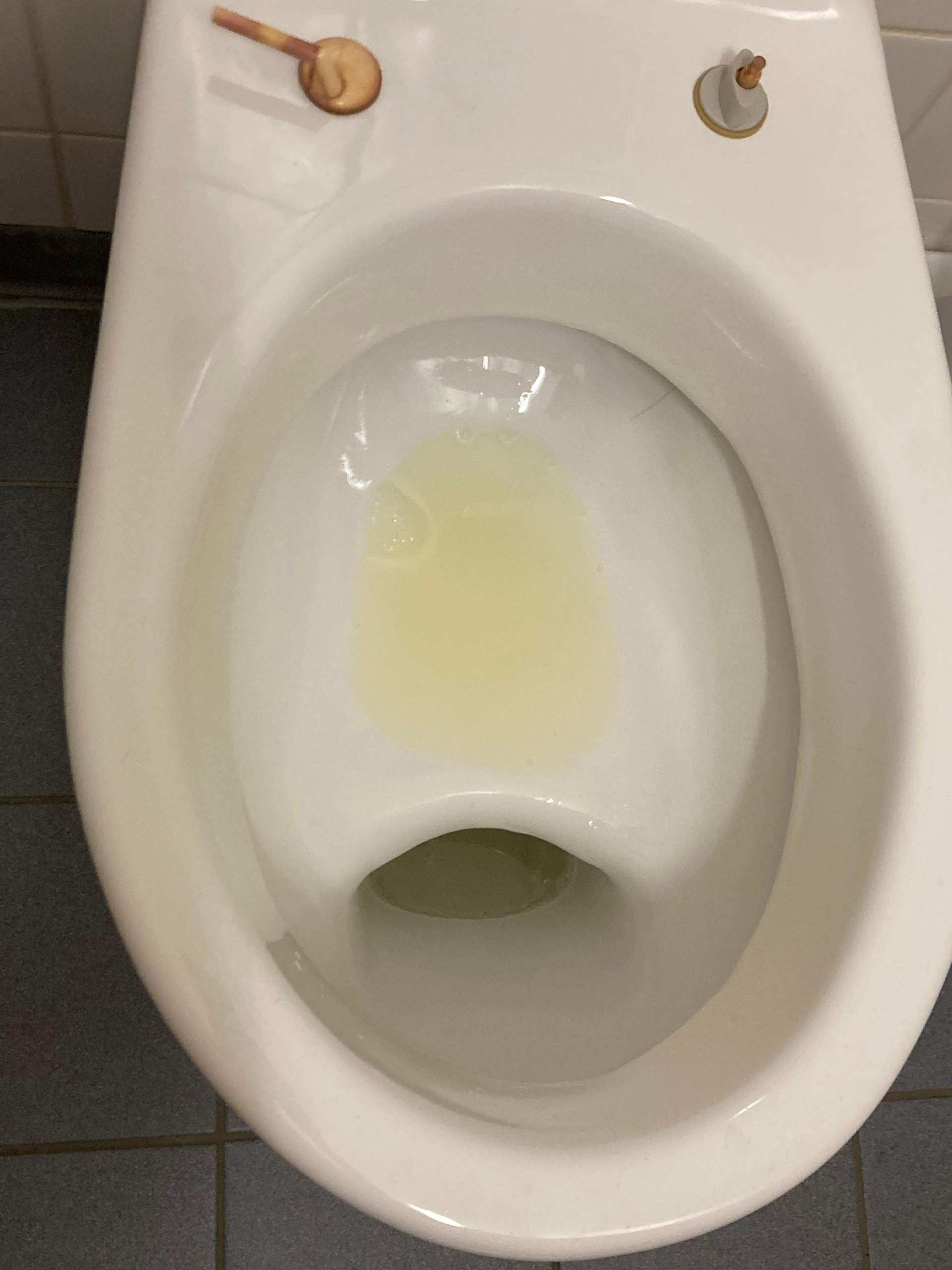 Gesunder Urin? (Schmerzen, Toilette)
