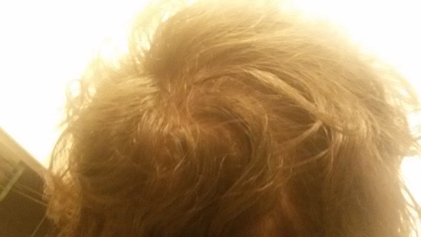 Glatze Mit 16 5 Bild Schule Haare Haarpflege