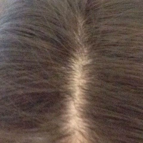 Ich habe pubertät Ich habe pubertät