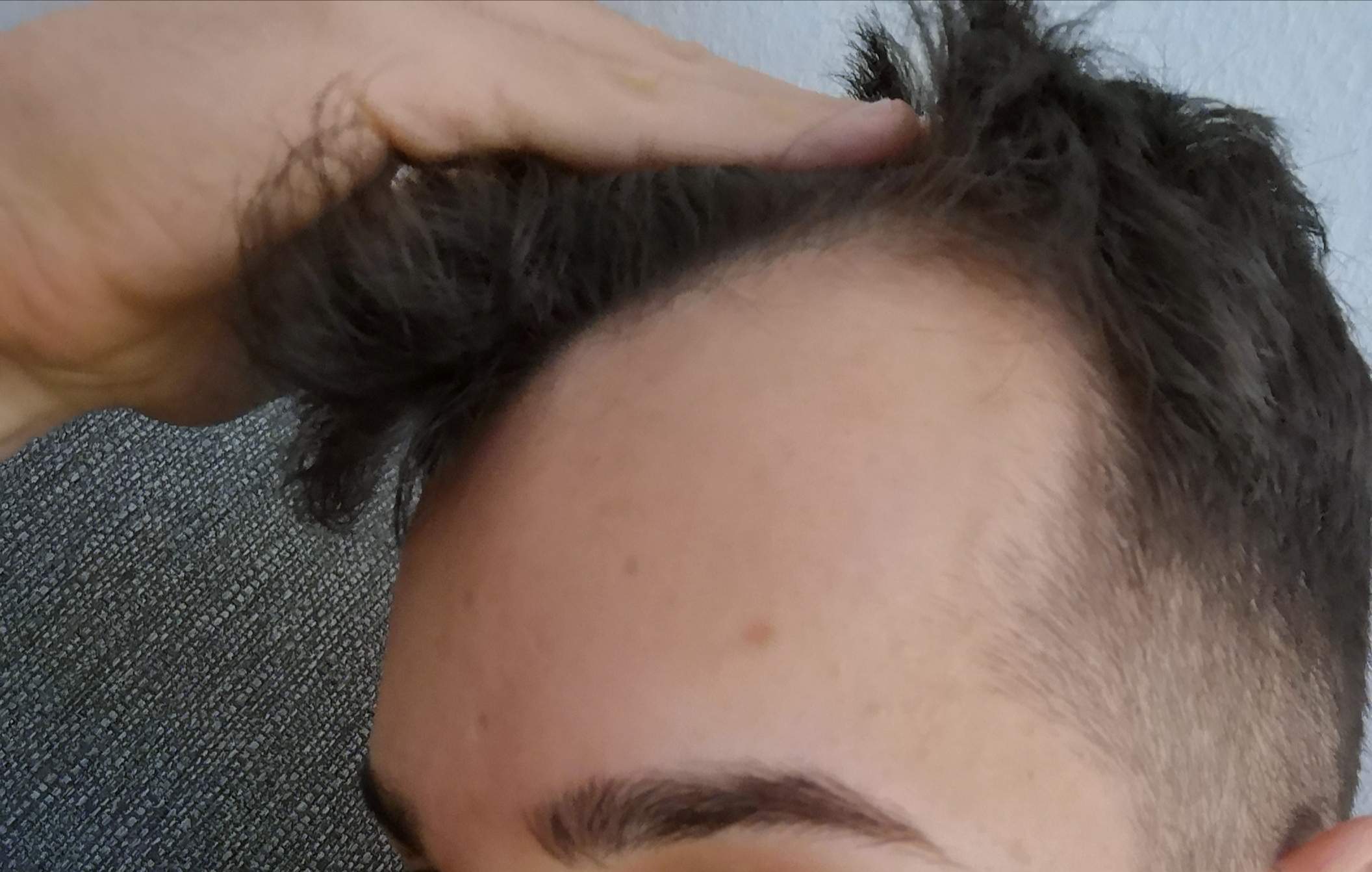 Frisuren für beginnende glatze