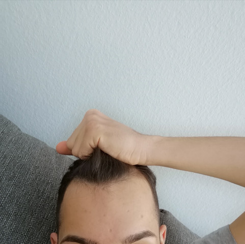 Glatze Schneiden Bei Geheimratsecken Frisur Gesicht Haarausfall