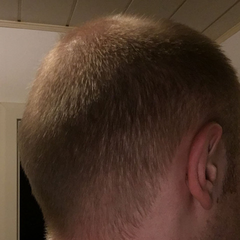 Glatze Millimeter Schnitt Haare Friseur Schneiden