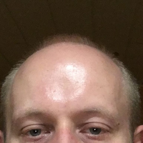 Glatze Millimeter Schnitt Haare Friseur Schneiden