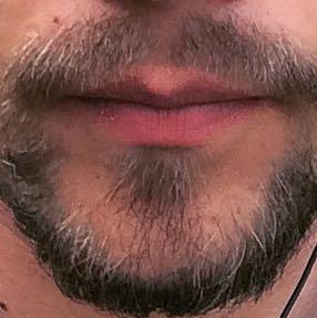 Graue Barthaare Mit 22 Bart Grau