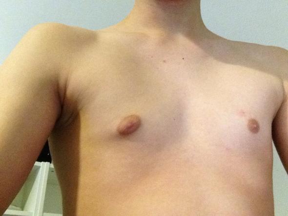 Hier ein Bild meiner Brust - (Brust, Brustwarzen, angeschwollen)