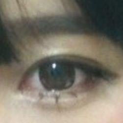 ..... - (Augen, Kontaktlinsen, Asia)