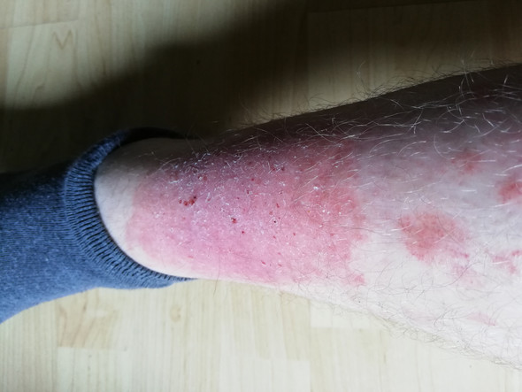 - (Gesundheit und Medizin, Gesundheit, Arzt)