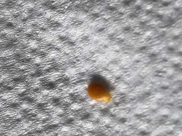 Gruner Durchfall Korner Im Stuhl Gesundheit Durchfallerkrankung Gruner Durchfall Korner Im Stuhl Gesundheit Durchfallerkrankung