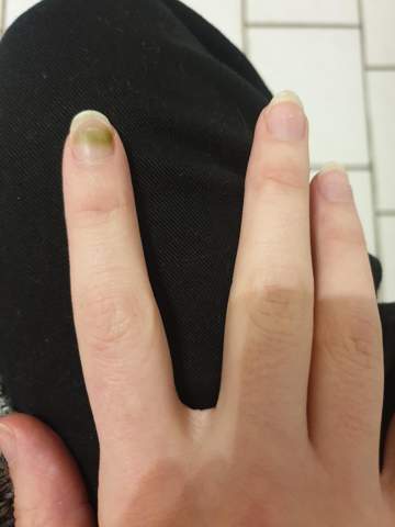 gruner nagel nach kunstlichen fingernageln