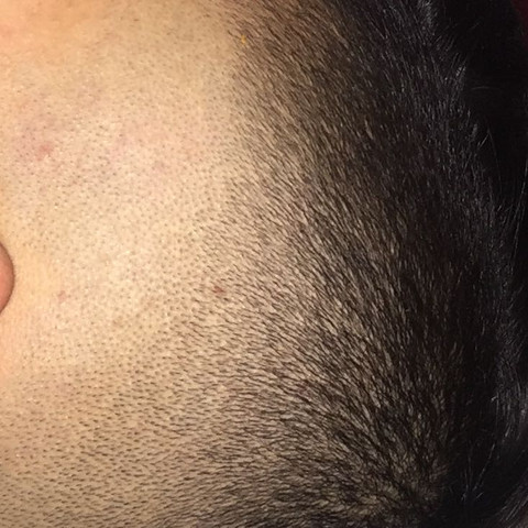 Guten Abend Heute War Ich Haare Schneiden Ich Habe Versucht Selber Ein Haar Weg Zu Machen Mit Elektro Rasierer Jetzt Habe Ich 0 5 Mm Und Ein Stuck 0 Mm Technik Gesundheit Kreativ