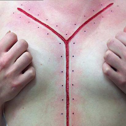 Scarification, cutting  - (Piercing, Tattoo, Bodymodification)