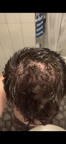 haare haarpflege haarausfall