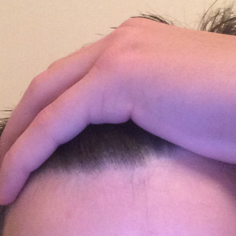 Haar Wachst Komisch Nach Unten Hilfeee Haare Wachsen Haaransatz Haar Wachst Komisch Nach Unten Hilfeee Haare Wachsen Haaransatz