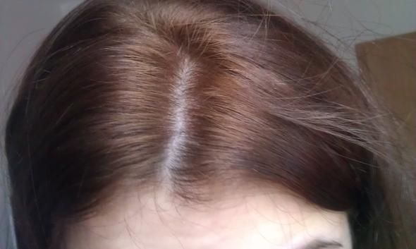 Haaransatz - (Haare, Haarfarbe)