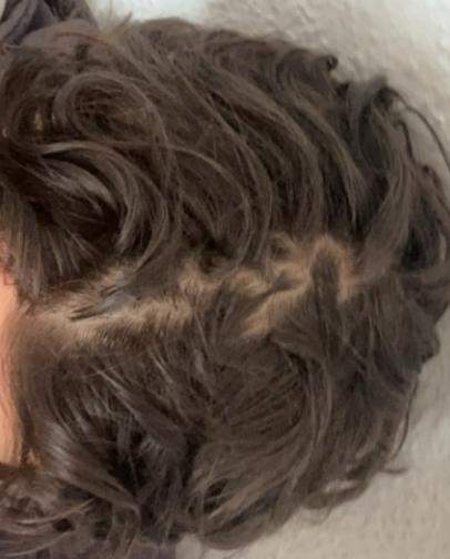 Haarausfall? (Männer, Aussehen, Friseur)