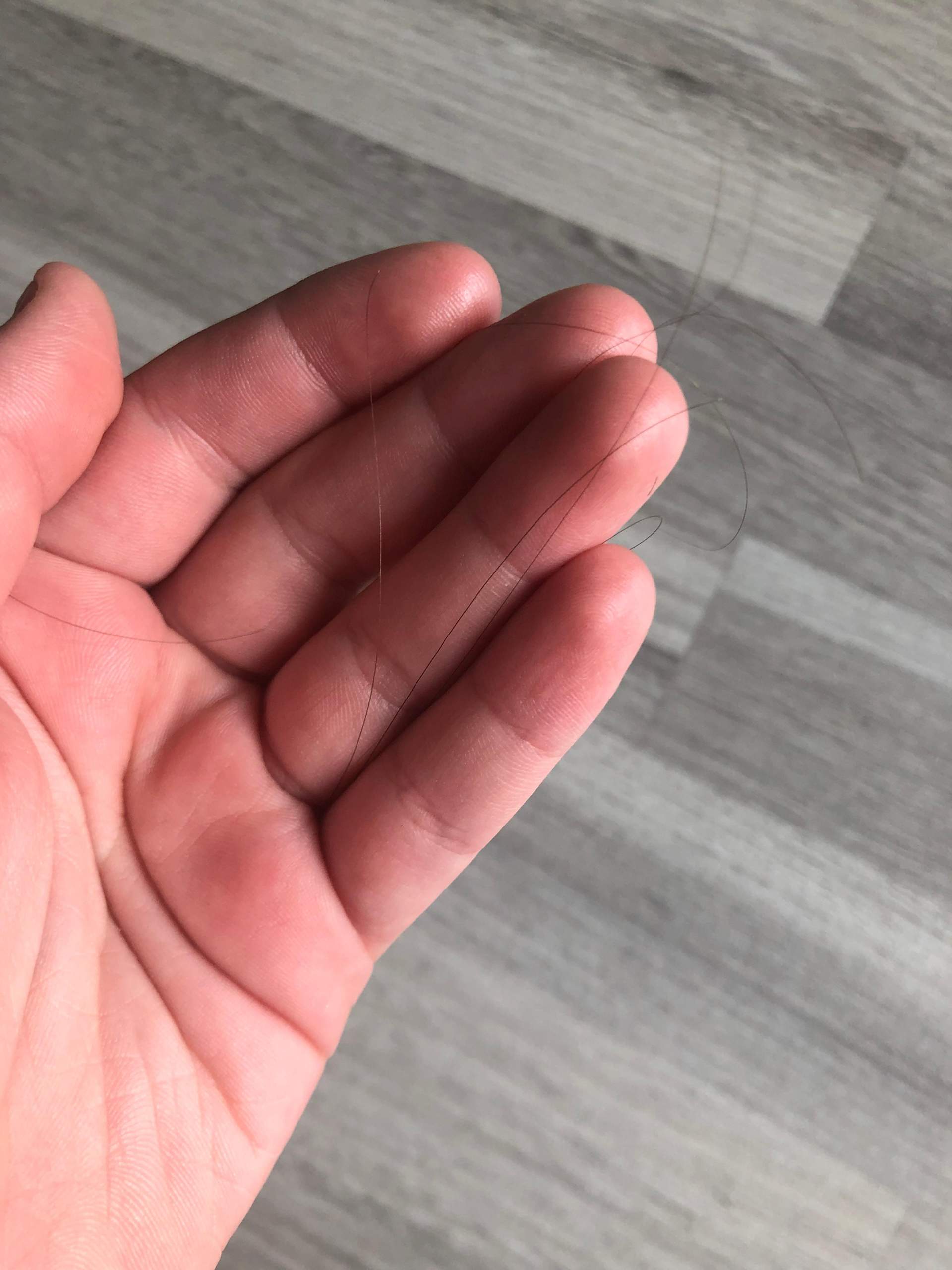 Haarausfall mit 14? (Männer, Pflege, Haarpflege)