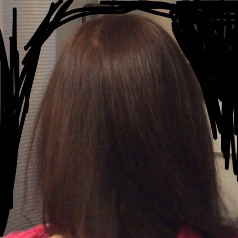 Ich hoffe man erkennt es einigermaßen - (Ernährung, Haarausfall, duenne-haare)