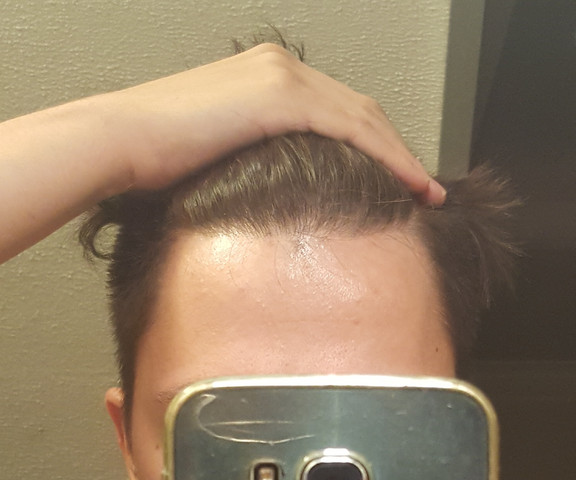 gesundheit und medizin haare arzt