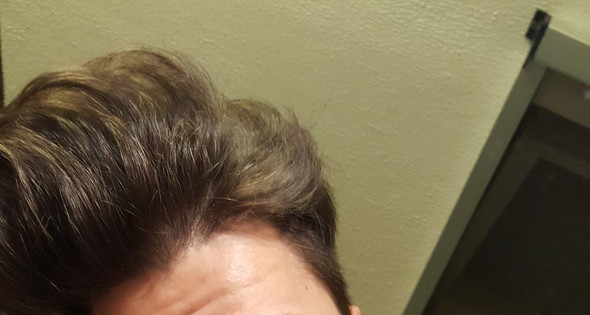 gesundheit und medizin haare arzt