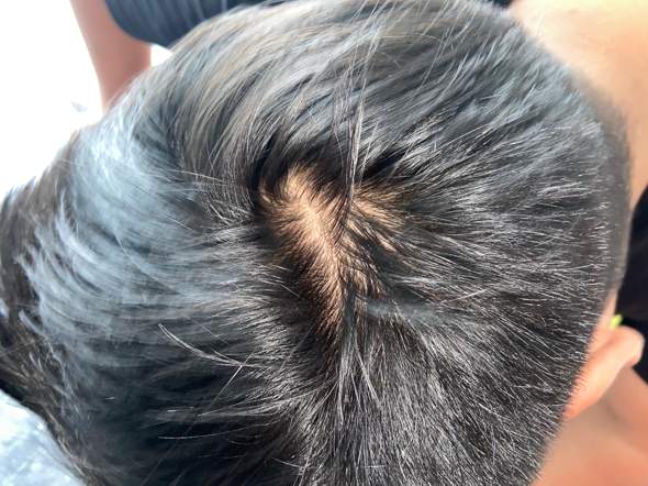 haarausfall oder ganz normal oder haare