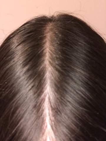 Haarausfall Oder Normal Foto Gesundheit Und Medizin Haare