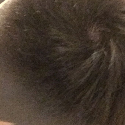 haarausfall wie lange noch gesundheit