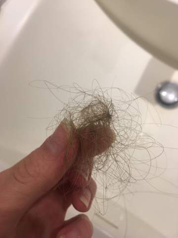 Haarausfall ist waschen viel beim normal wie Wie viel