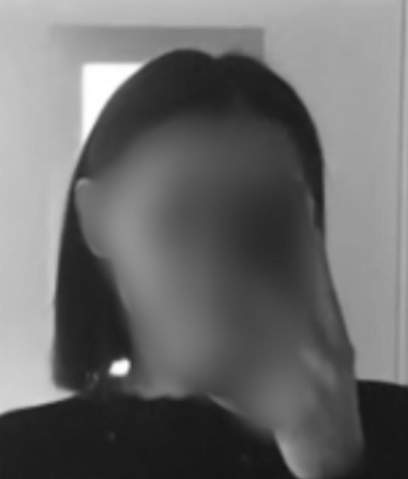 - (Haare, Glatze)