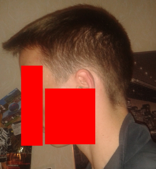 haare abrasieren bei haarausfall