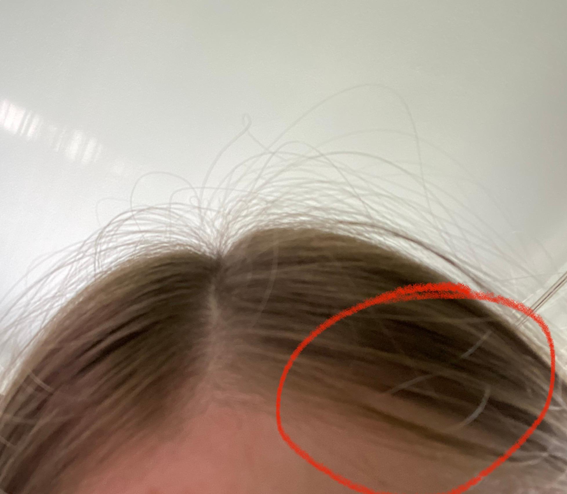 haare am ansatz fettig nach einem oder