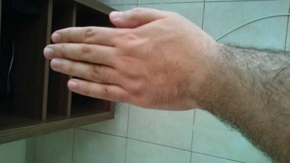 haare an den handen und fussen manner