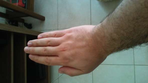 haare an den handen und fussen manner