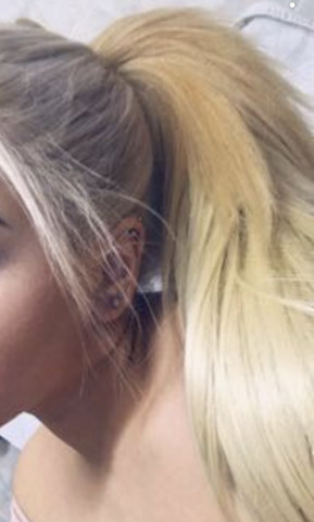 Haare Ausgefallen Horror Geschichte Siehe Unten Wie Lange Dauert Es Bis Sie Nachwachsen