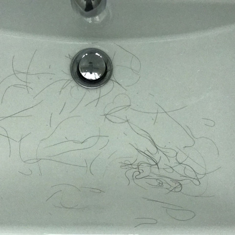 Haare Fallen Aus Nach Haareschneiden Rontgen Ausfall Haare Fallen Aus Nach Haareschneiden Rontgen Ausfall